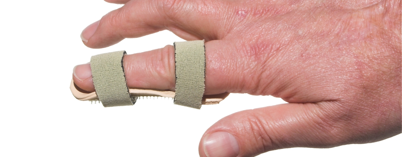 Finger-fractures-Cascade-Hand-&-Orthopedic-Rehab-Fort-Meyers-FL