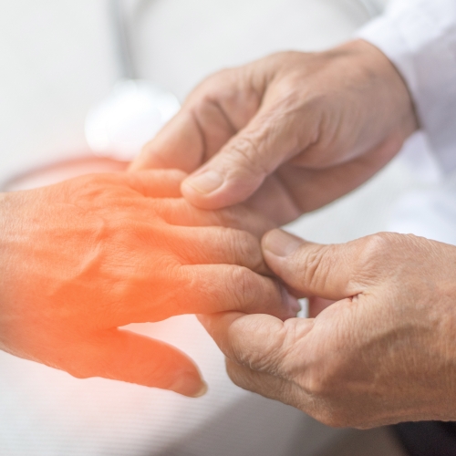 Hand-fractures-Cascade-Hand-&-Orthopedic-Rehab-Fort-Meyers-FL