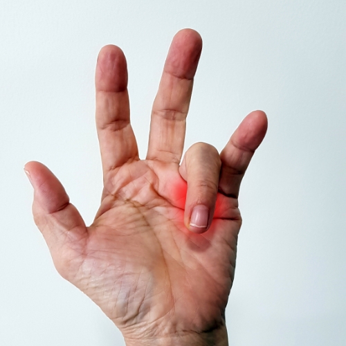 Trigger-finger-Cascade-Hand-&-Orthopedic-Rehab-Fort-Meyers-FL